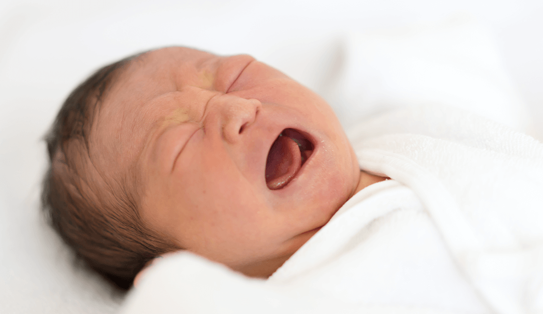 婴幼儿腹痛间歇性哭闹 竟是「肠套迭」肠子卡住了! 婴幼儿腹痛间歇性哭闹 竟是「肠套迭」肠子卡住了!