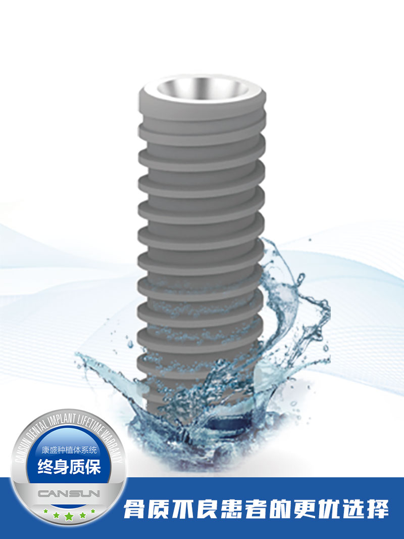 康盛柱形亲水种植体