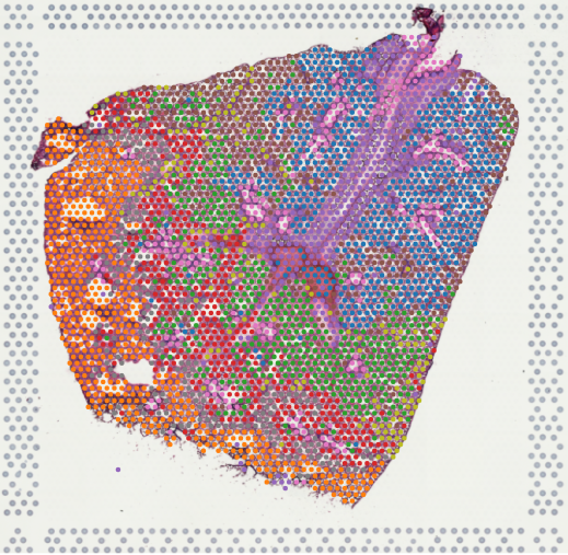 Cloud Zoom small image