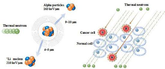BNCT | 硼中子俘获治疗有助于抑制乳腺肿瘤