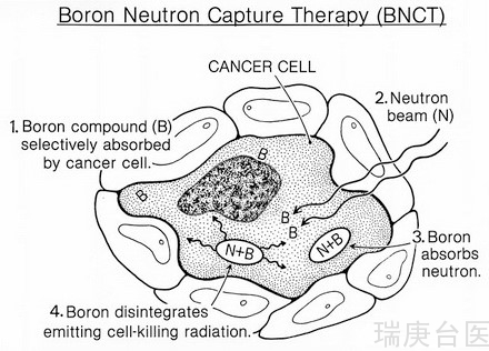 BNCT | 解析硼中子俘獲治療