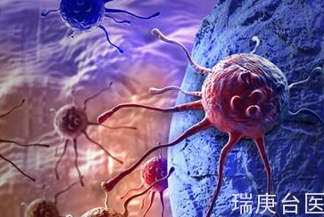 硼中子治療&質子治療 | 什么原因引起膠質母細胞瘤？