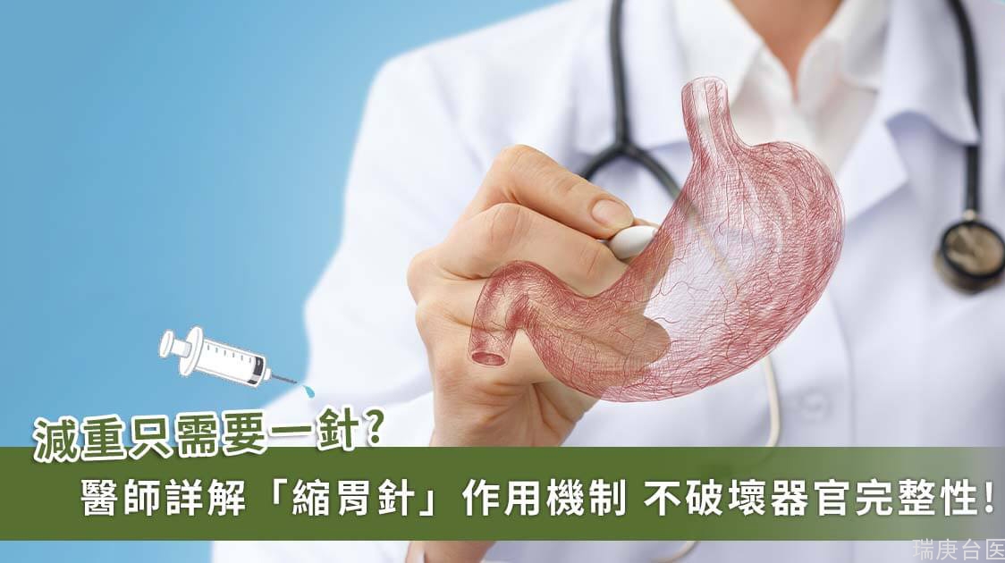 「缩胃针」真的能「缩胃」吗？台湾医师详解「胃肉毒杆菌注射」的作用机制、恢复期、副作用、费用