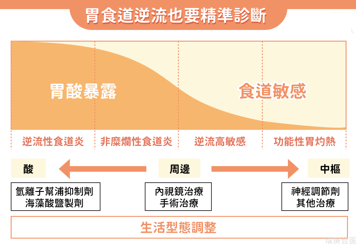 改善胃食道逆流两大撇步！腰带别太紧＋腹式呼吸就能大有改善